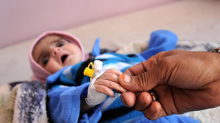 طفلة مصابة بالكوليرا اليمن الحثويين