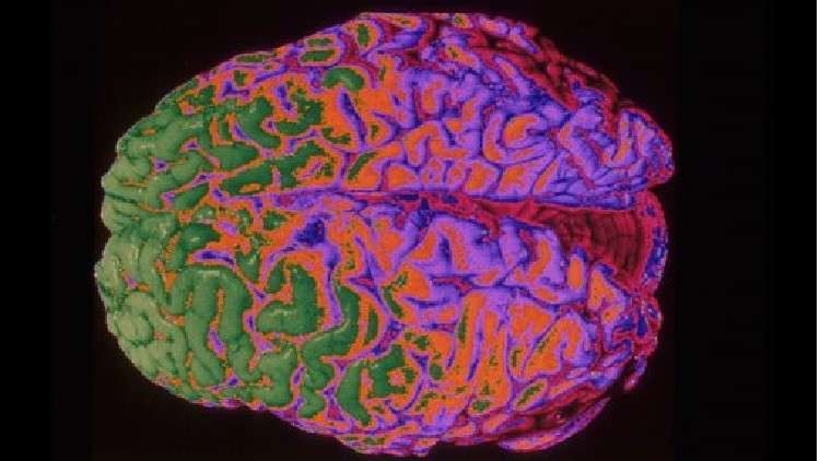 العلماء في طريقهم إلى ابتكار دماغ واع